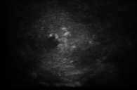 AS17-158-23869