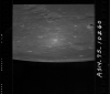 AS14-75-10260