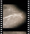 AS15-93-12580